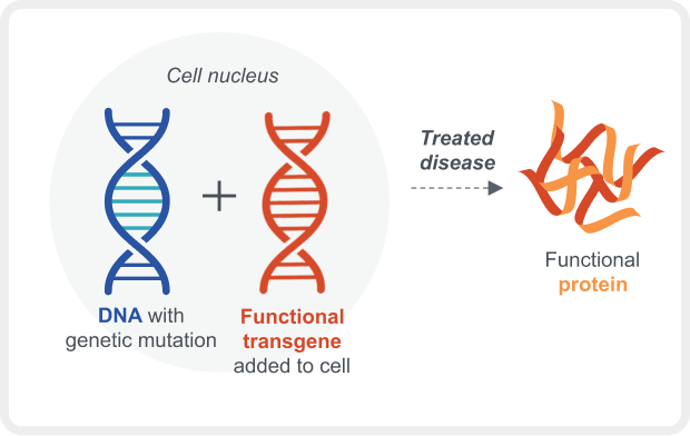 Examples of gene therapy