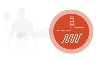 An illustration of CRISPR-based gene editing being infused into the liver